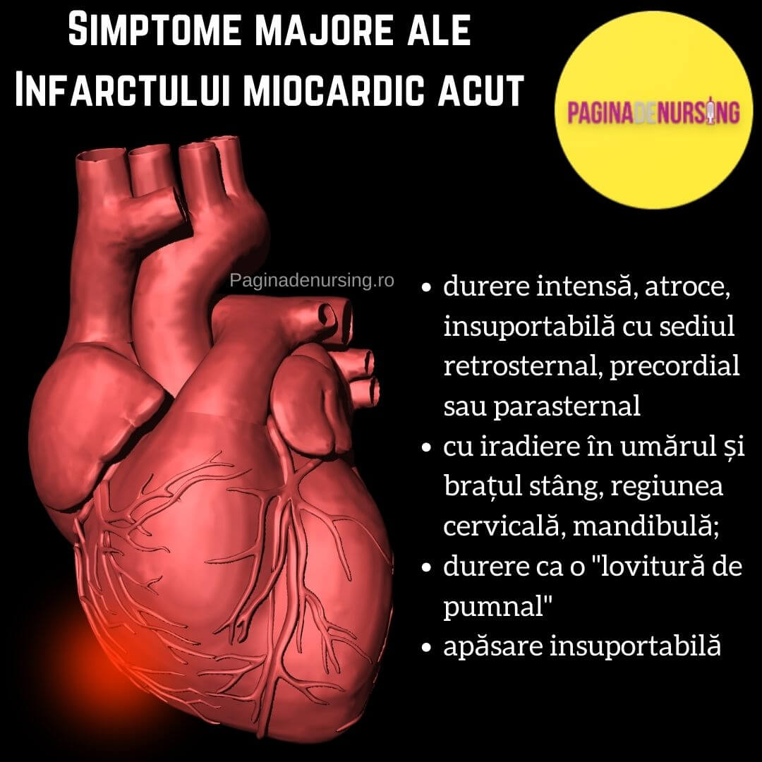 Infarctul miocardic acut îngrijirea pacientului cu infarct miocardic