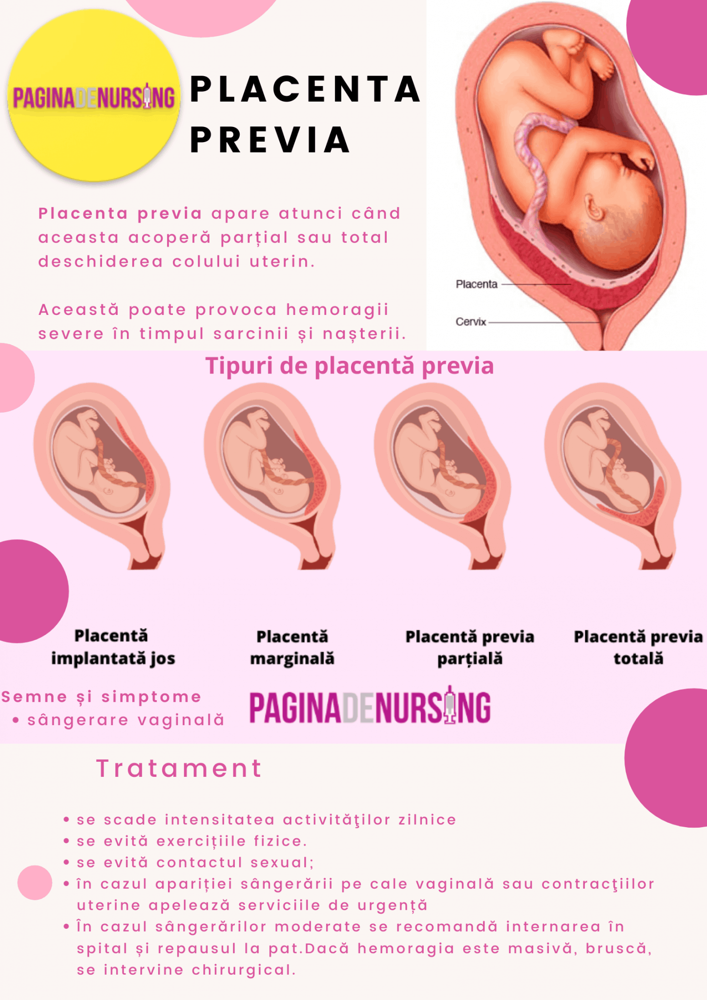 placenta-previa-ngrijirea-pacientei-cu-placenta-previa-pagina-de