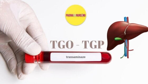 Transaminazele Tgo Tgp Pagina De Nursing 4330