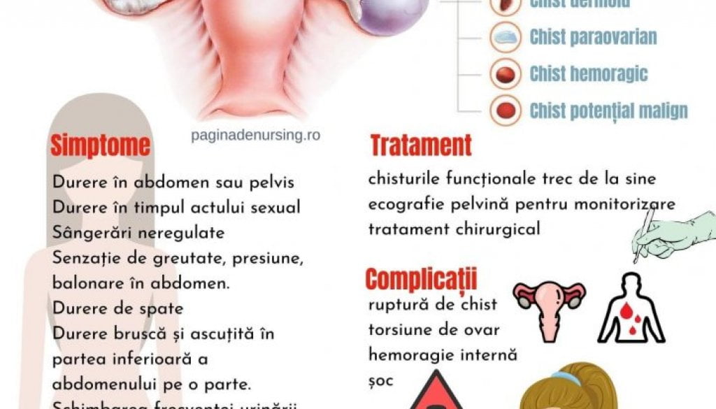 Operatia De Chist Ovarian Chistul ovarian (îngrijirea pacientei cu chist ovarian) – Pagina de Nursing